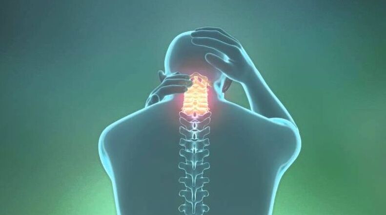 Osteochondrosis of the cervical region