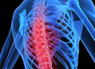 osteochondrosis of the thoracic spine