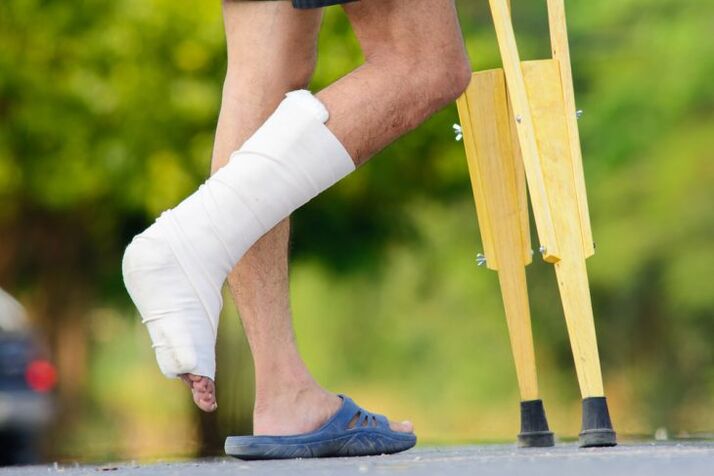 ankle injuries as a cause of osteoarthritis