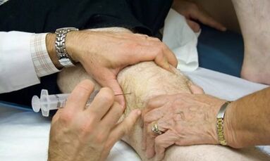 How to distinguish arthritis from arthrosis