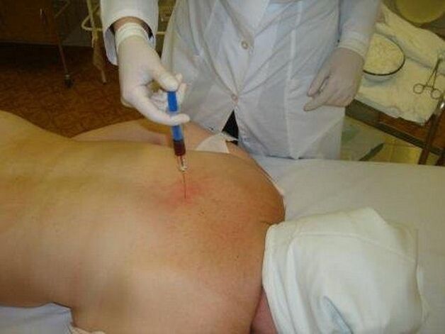 Preparations for osteochondrosis